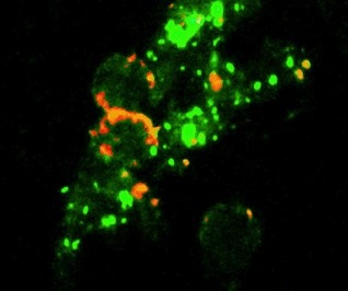 cytokine aggregates