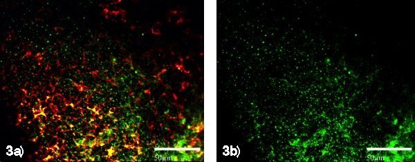 dendritic_cells